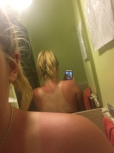 Oh. Dear. Thats gonna take months to fade!